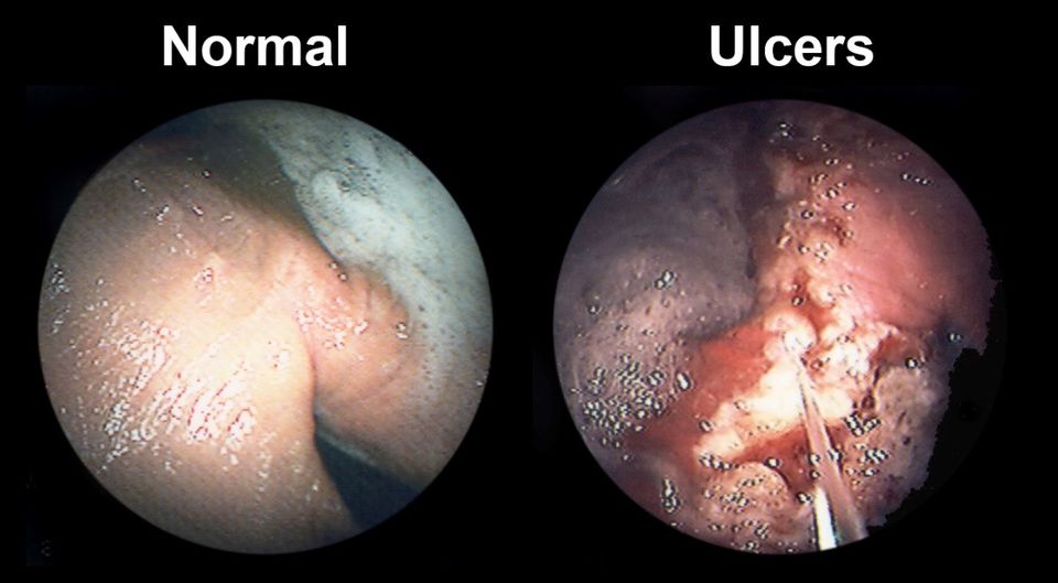 symptoms of ulcers in horses